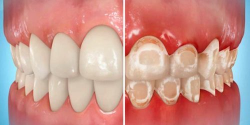 anke-meneve-orthodontist